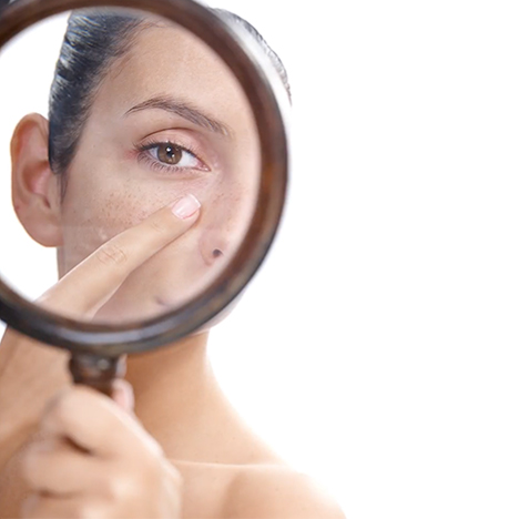 Eye area